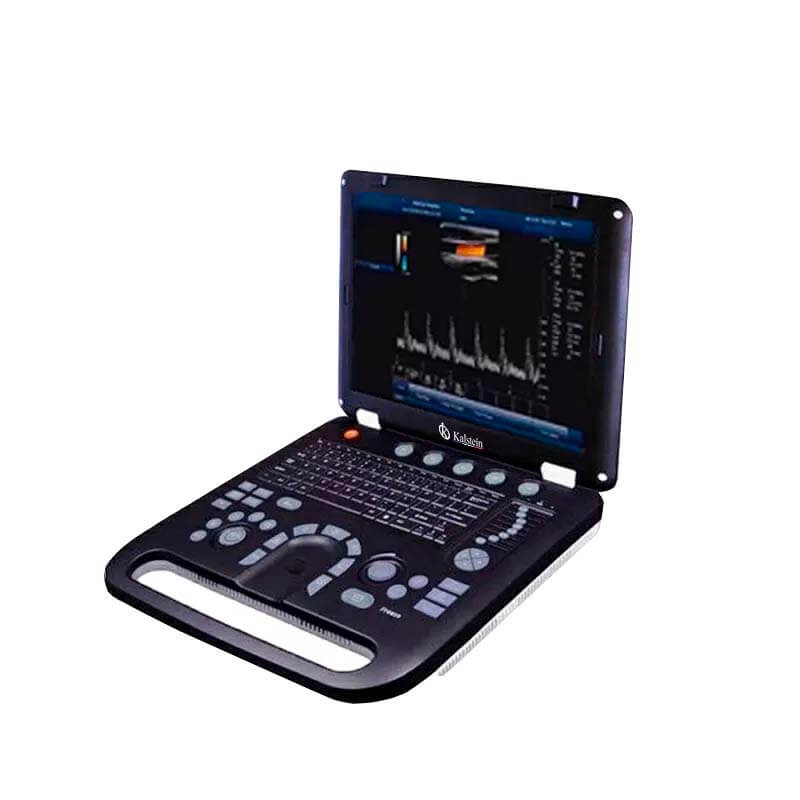 Evaluating ROI and Cost-Benefit Analysis for Ultrasonic Color Doppler Diagnostic Systems