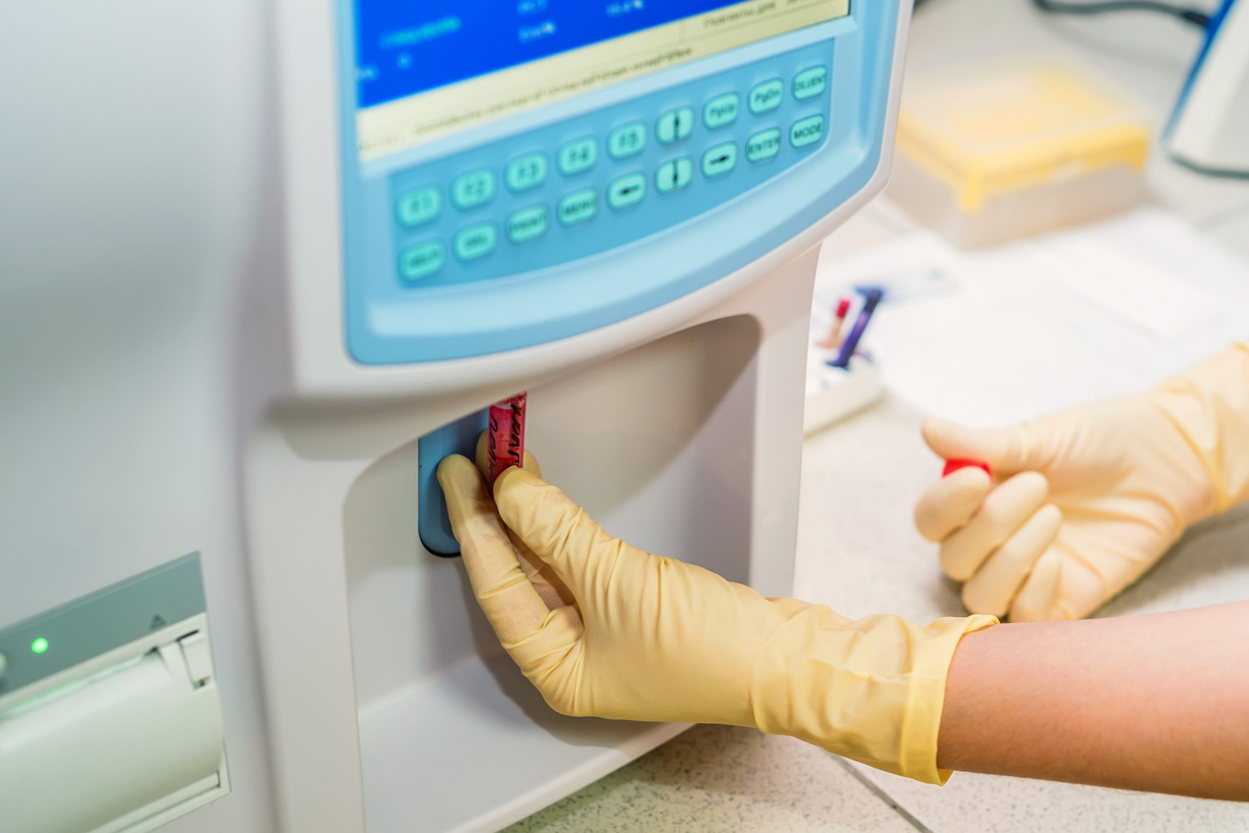 Comment choisir le bon analyseur biochimique ?