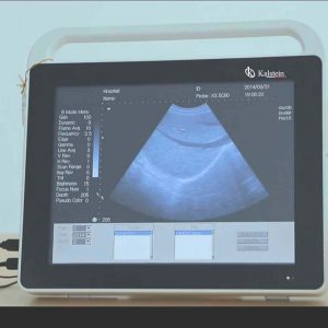 How does an ultrasound scanner work?