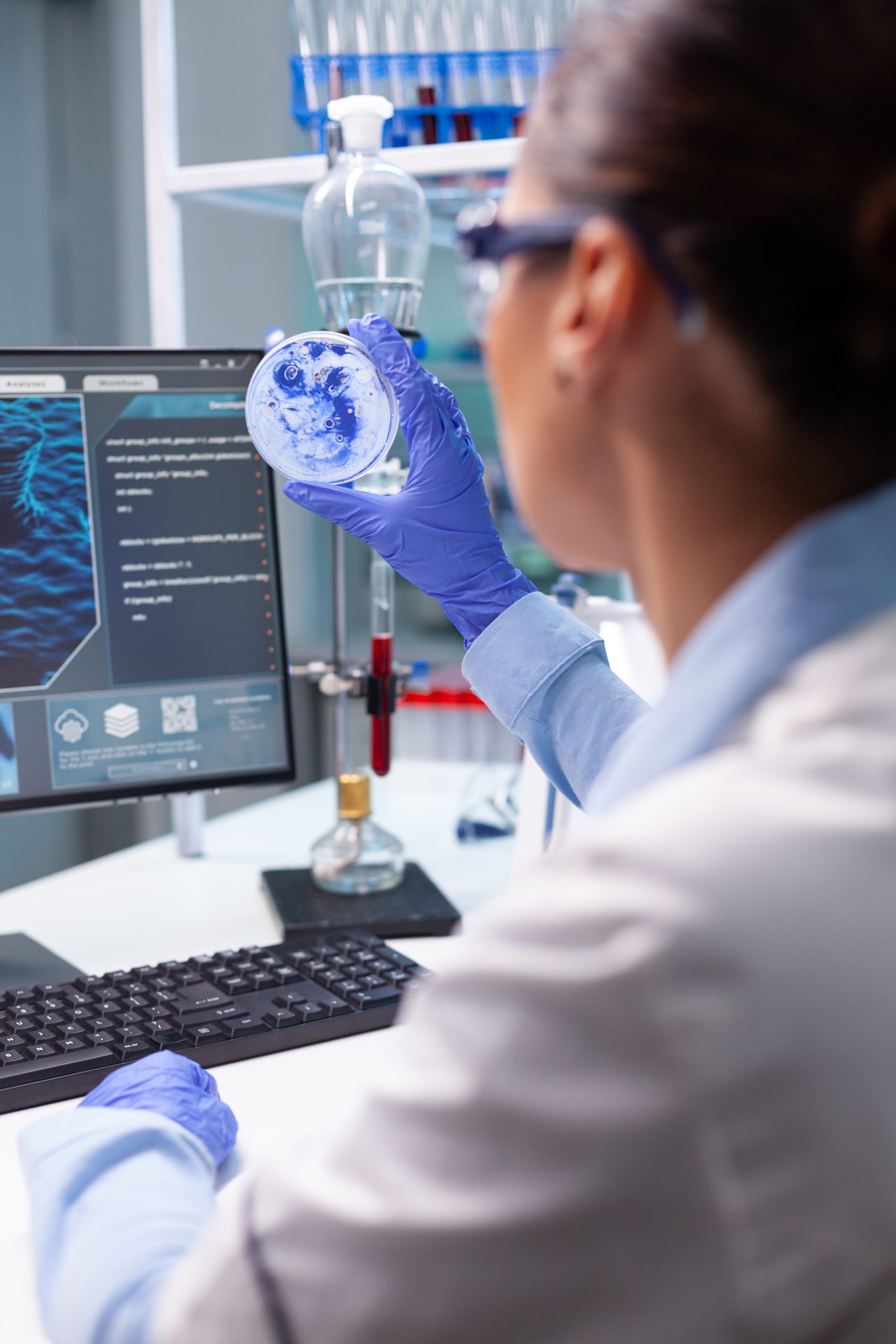 ELISA microplate reader: When do we need to use it?